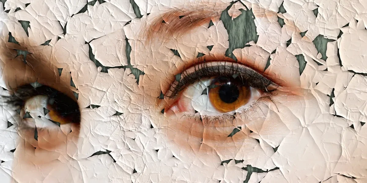 EMDR